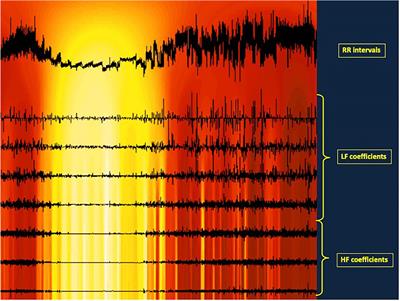Targeting autonomic nervous system as a biomarker of well-ageing in the prevention of stroke